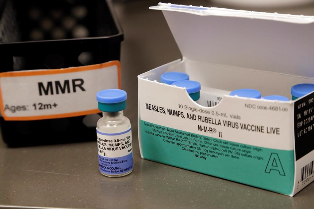 Another case of measles reported in Ontario through travel