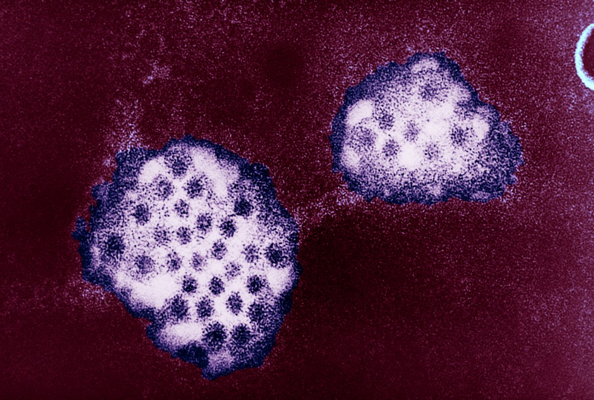 An Electron Micrograph Of The Norovirus, With 27 32Nm Sized Viral Particles. Norwalk Viruses And Related Caliciviruses Are Important Causes Of Nonbacterial Gastroenteritis In The United States. An Estimated 181,000 Cases Of This Type Of Food Poisoning Occur Annually. (Photo By BSIP/UIG Via Getty Images)