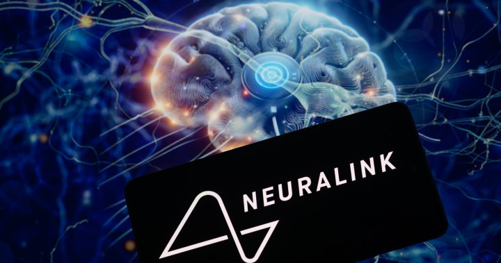 Компанията Neuralink за мозъчен компютърен интерфейс BCI на Илон Мъск