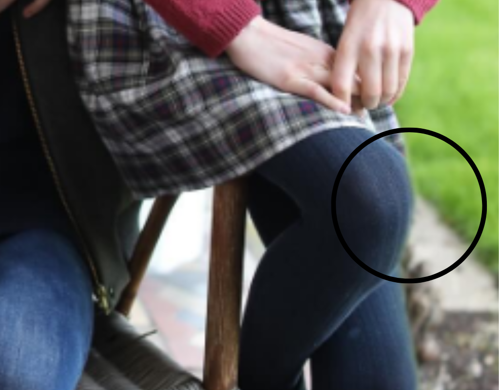 A close-up of Charlotte's knee.