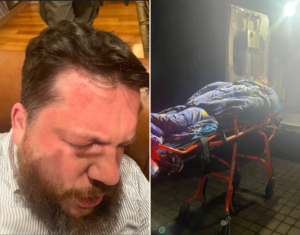 Photo of Leonid Volkov's bruised face and an image of him being loaded into an ambulance after he was attacked outside his home in Lithuania on March 12, 2024.