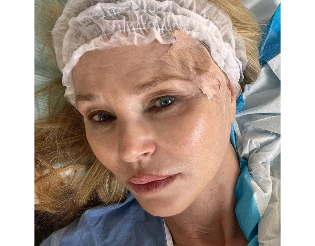 Supermodel Christie Brinkley shared a photo of her post-operation after getting skin cancer removed from her face.