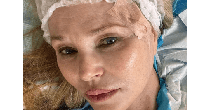 Супермоделът Кристи Бринкли е с премахнат рак на кожата от лицето: „Имах късмет“