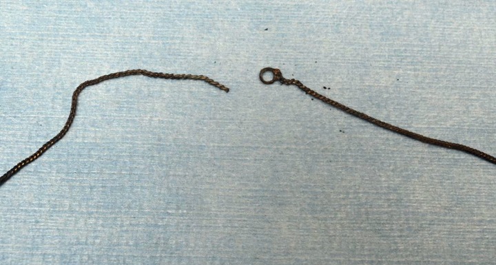 Предупреждение Тази статия съдържа обезпокоително съдържание Мъж е бил умишлено разчленен