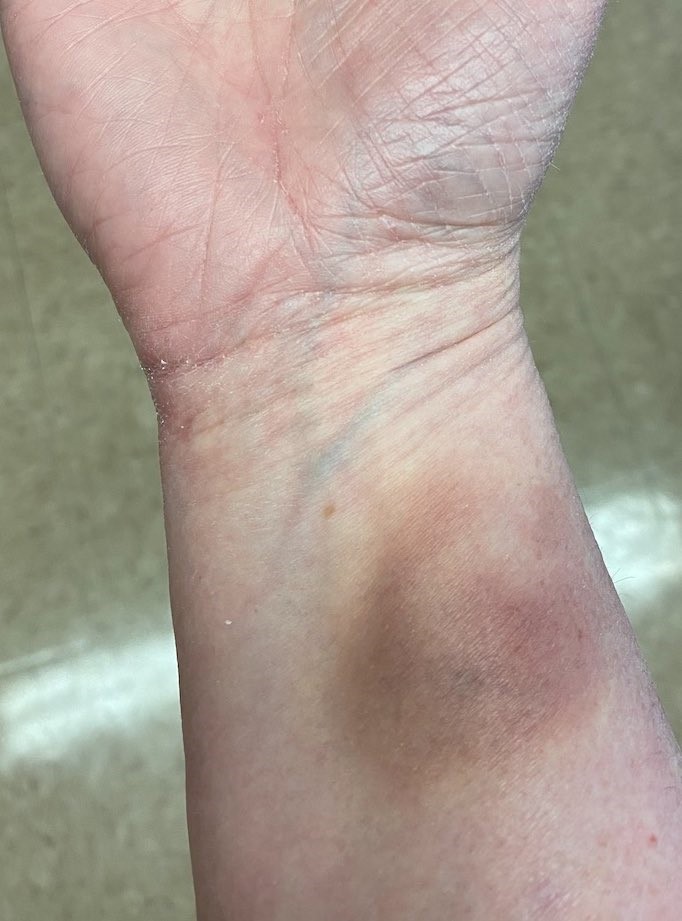 Президентът на Съюза на учителите в Нова Скотия подчертава проблема