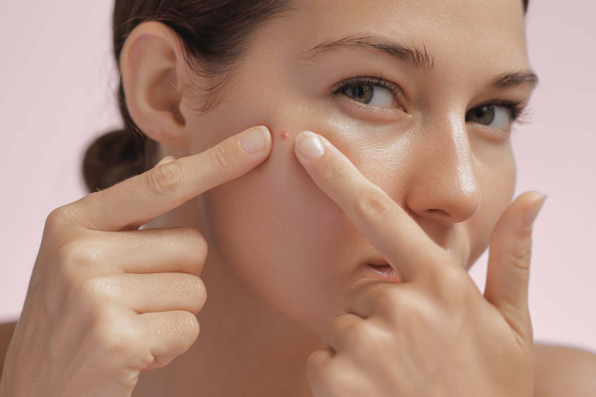 Meet your new favourite pimple treatment.