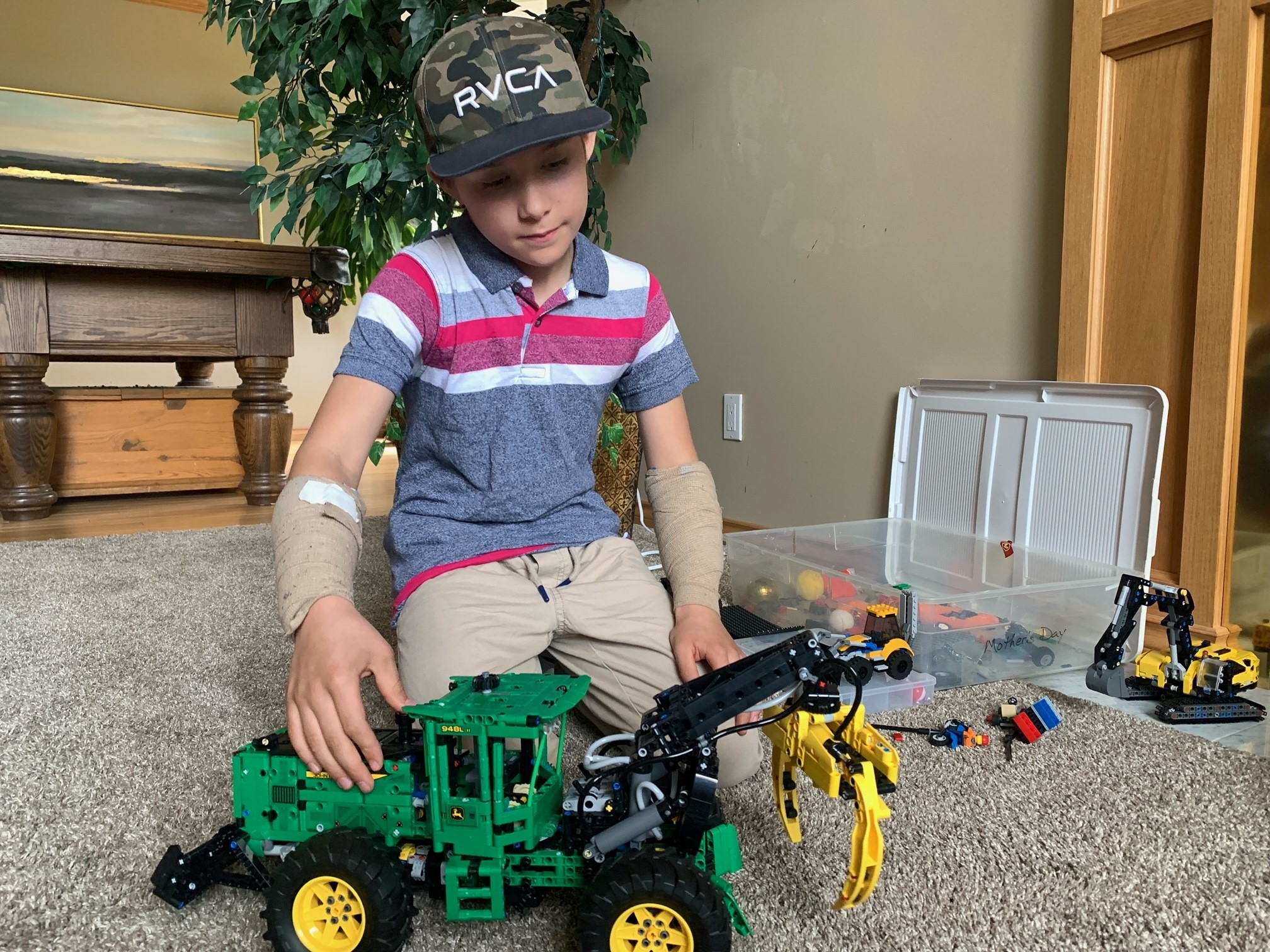 Ръцете на Броуди Лаховски са покрити с превръзки криещи рани