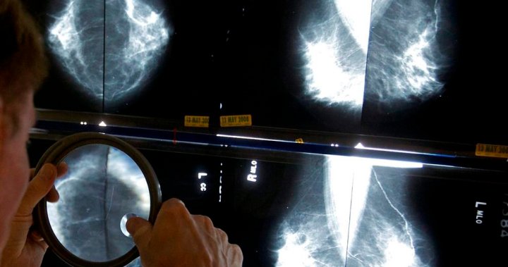 Медицински експерти искат по-често преразглеждане на националните насоки за скрининг на рак