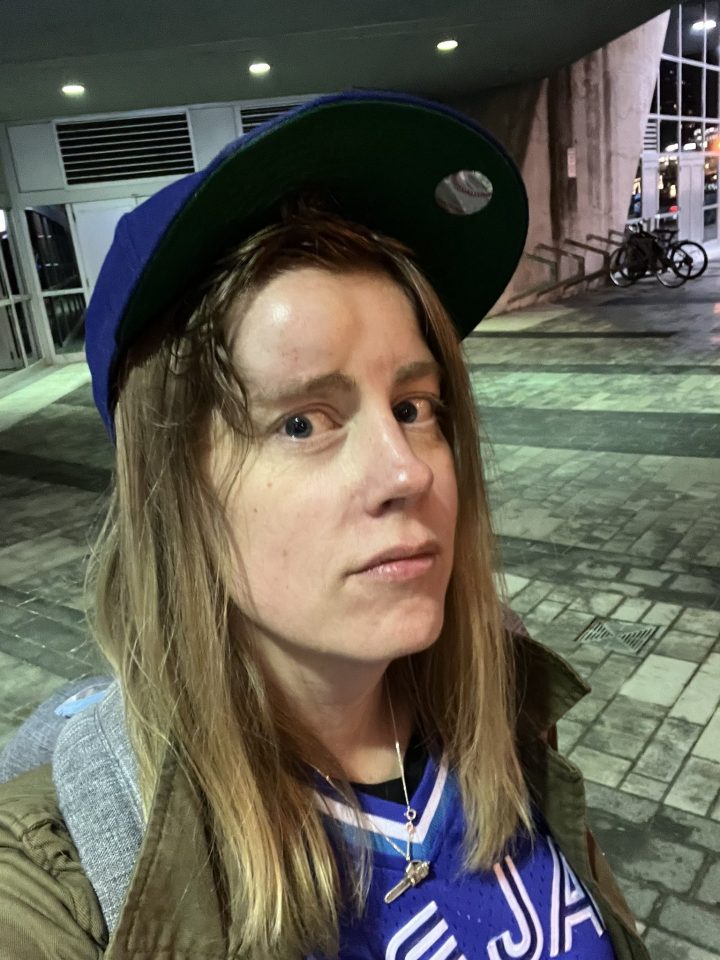 Жена която беше ударена в лицето от изгаряща фаул топка