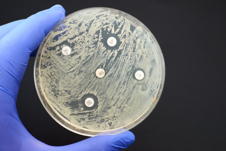 Canada introduces new guidelines to tackle antimicrobial resistance