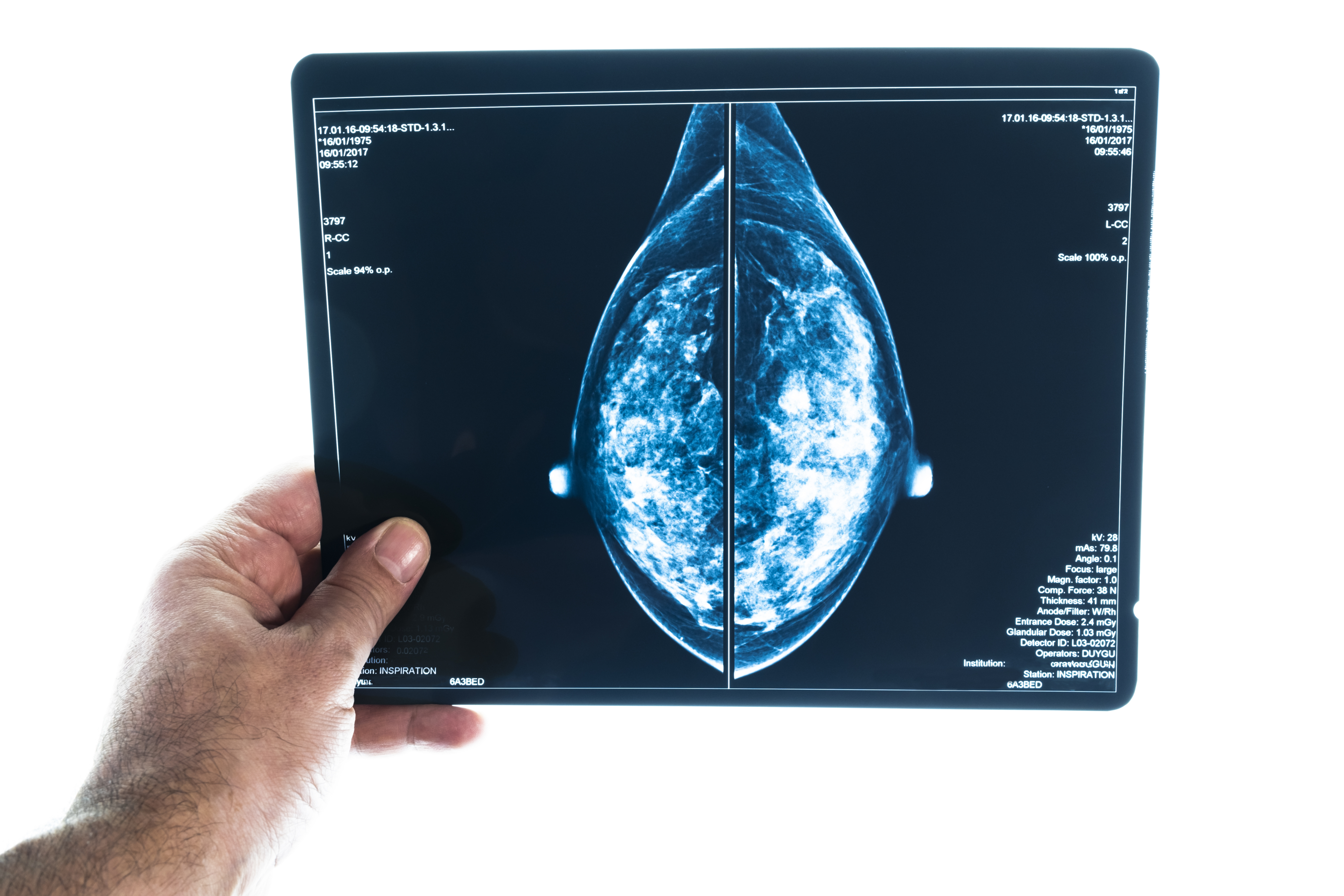 Насоките на Канада за рутинни скрининги за рак на гърдата