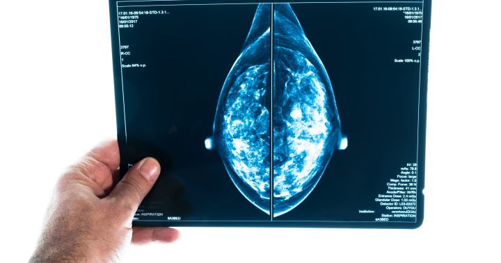 Насоките на Канада за рутинни скрининги за рак на гърдата