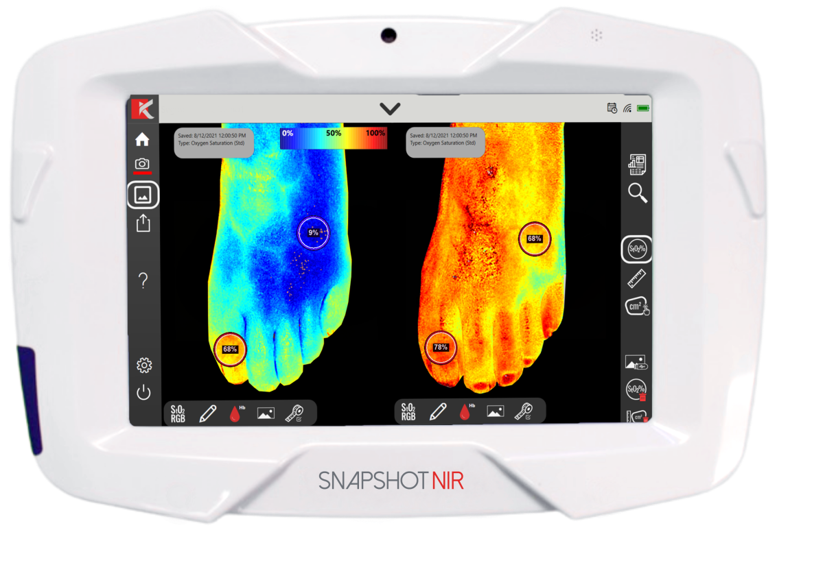 The device is changing wound healing.