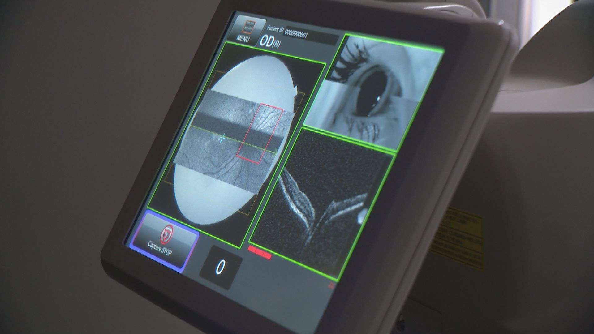 Болестта на Алцхаймер скоро може да бъде открита в кабинета