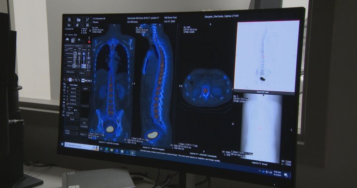 „Скок напред:“ Болницата в Халифакс е първата в Канада със скенер за ядрена медицина