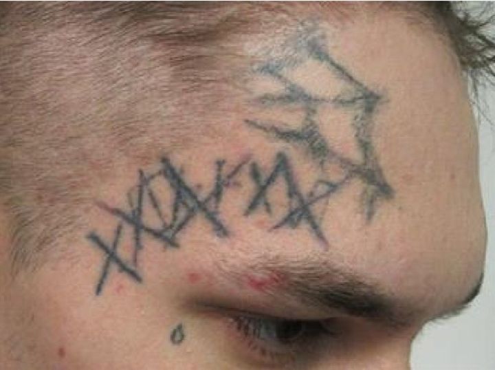 The RCMP in Alberta continue to look for Elijah Blake Strawberry, who is one of two suspects in a shooting incident that occurred on Aug. 6, 2024. In this photo, Strawberry's right forehead is shown.