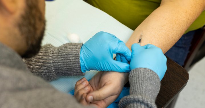 Mpox vaccine is 58% effective after one dose, Canadian study finds