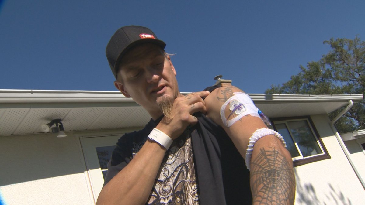 Lawrence Reimer shows where he receives powerful antibiotics daily to fight a severe staphylococcus infection that nearly killed him while he says he was largely ignored at Concordia ER, typecast as a drug addict with kidney stones