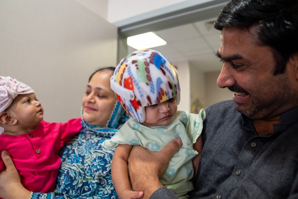 Father Rehan Ali and mother Nazia Parveen take care of Mirha and Minal, Pakistani twins born conjoined at the head, during their healing process after surgery at Bilkent City Hospital in Ankara, Turkiye on September 06, 2024.