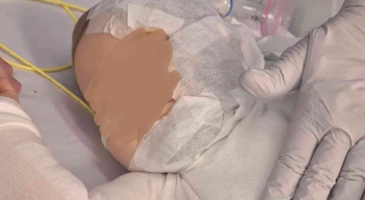 Photo of baby Luka in the hospital with bandages on his face and chest after the Aug. 27 attack.