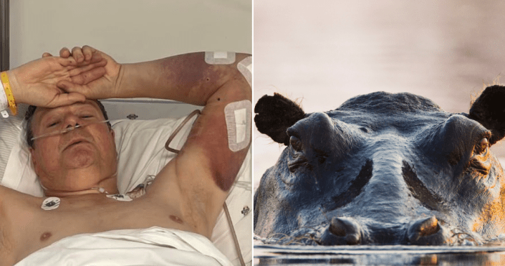 ‘Like a ragdoll’: Man attacked by hippo recounts moment he was ‘grabbed’ – National