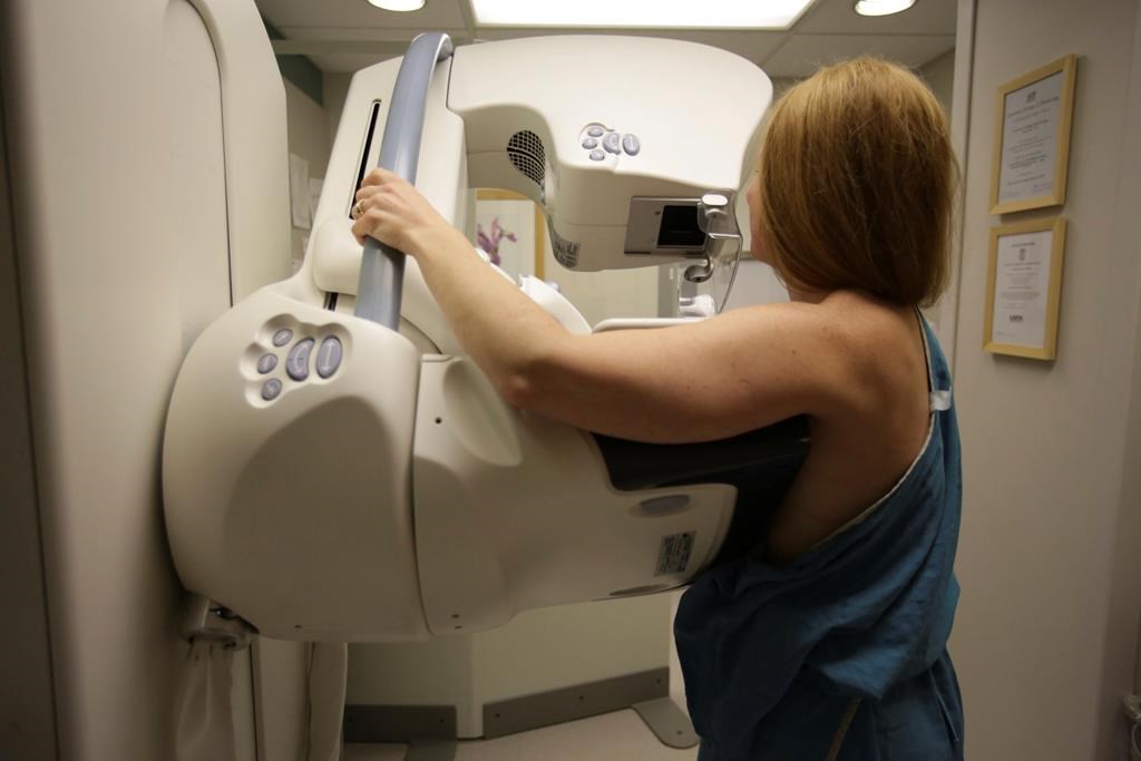 Ontario lowers mammogram self-referral age to 40 years old from 50