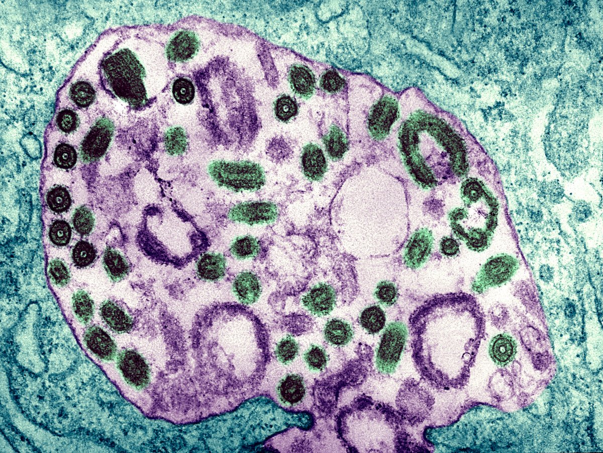 Electron Micrograph Of The Marburg Virus. Marburg Virus, First Recognized In 1967, Causes A Sever Type Of Hemorrhagic Fever, Which Affects Humans, As Well As Non Human Primates.