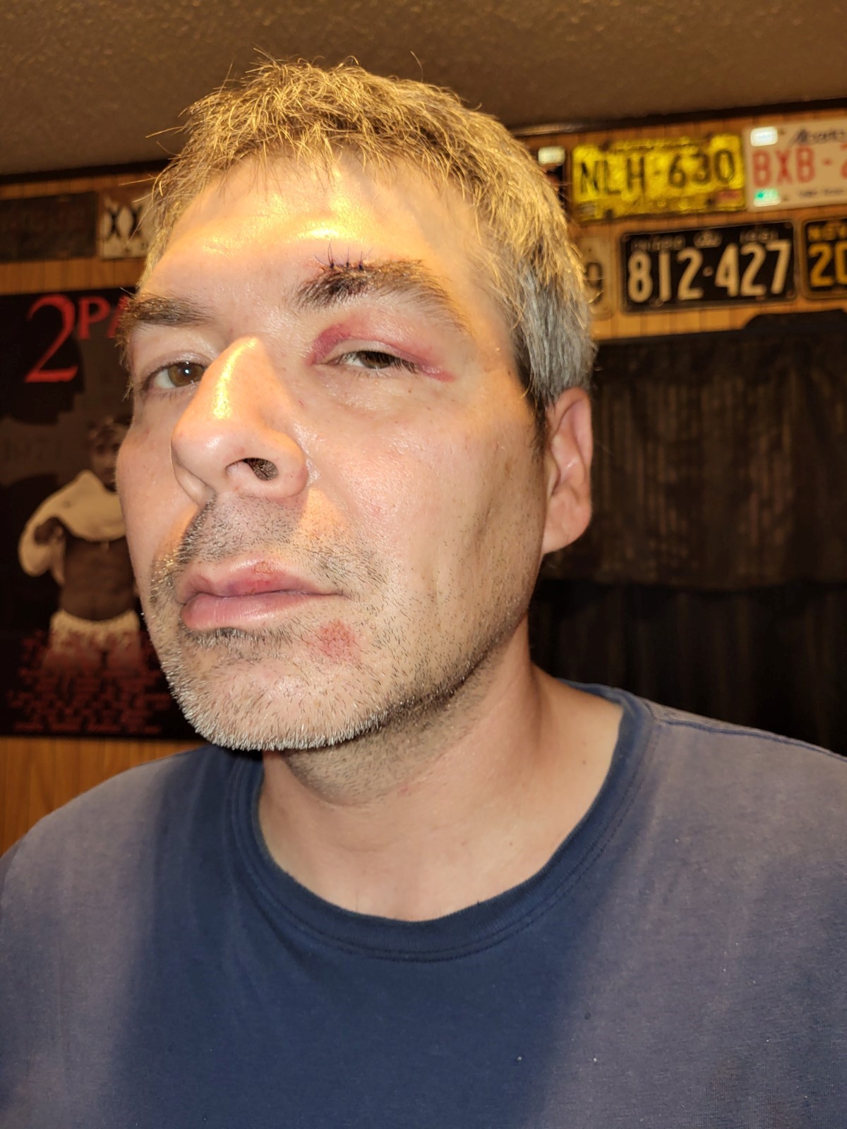 Dennis Boucher, 43, after being injured during an arrest in Lac La Biche, Alta. on Tuesday, Oct. 1, 2024.