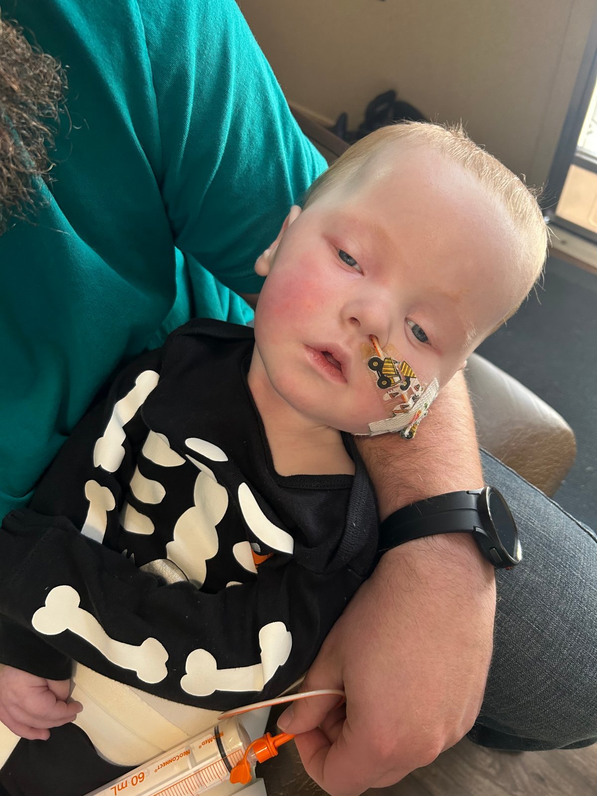 Ten month old Tucker suffers from a rare genetic disease called D-Bifunctional Protein Deficiency that causes deterioration of the nervous system, frequent seizures,, loss of hearing and sight and eventually is fatal.