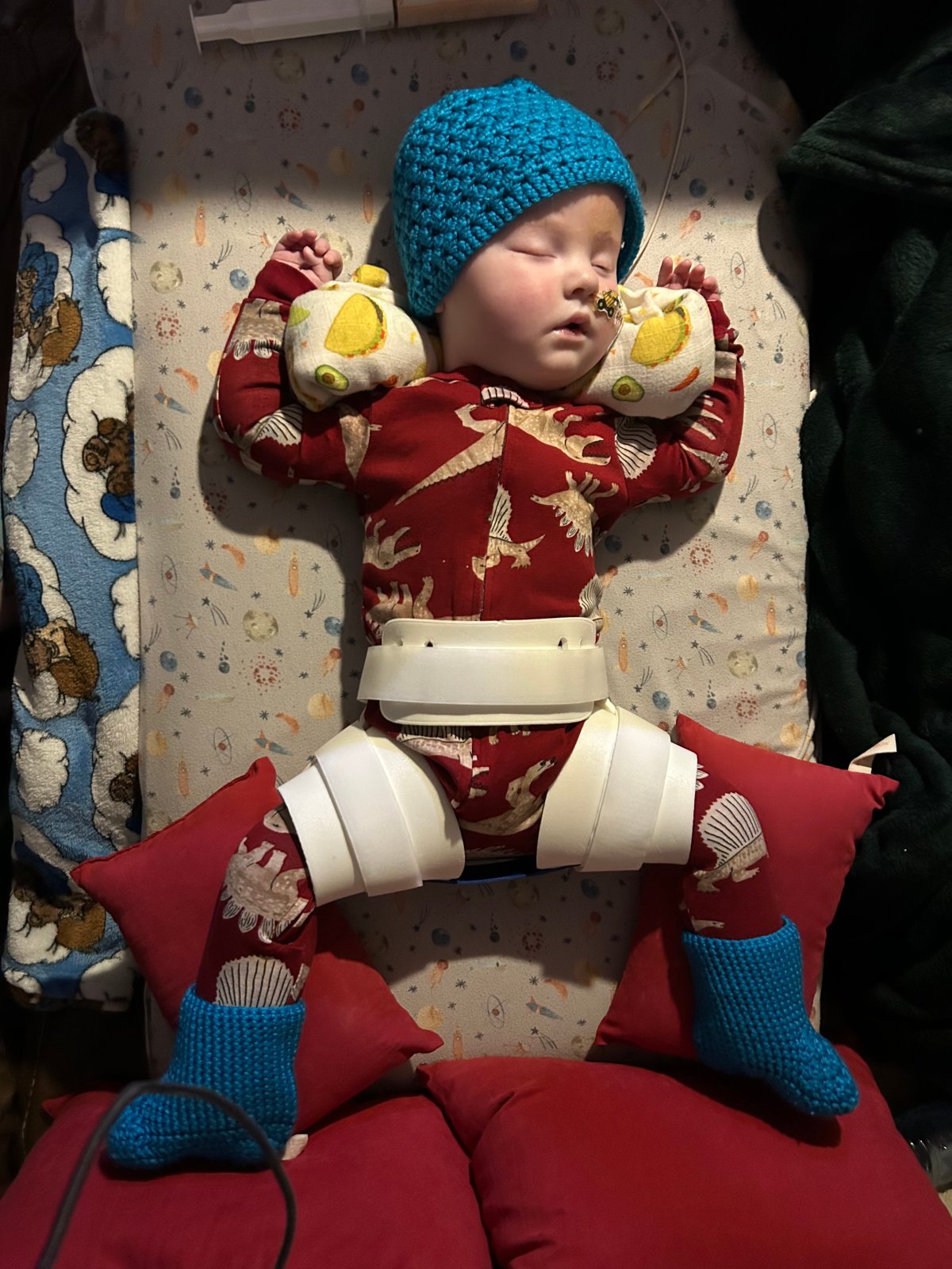 So far Tucker's neighbours have raised $4,200 for his family. Amongst their immediate needs is a new place to live for the winter and a car seat that will allow Tucker to lie flat.