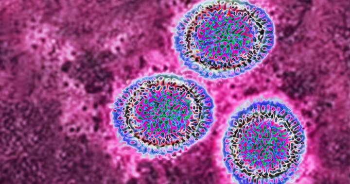 3 kids die from influenza A-related complications since start of December in Ontario 3 kids die from influenza A-related complications since start of December in Ontario