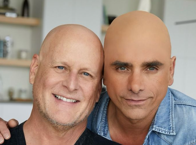 John Stamos shared photos of the bald cap he wore to support his friend Dave Coulier.