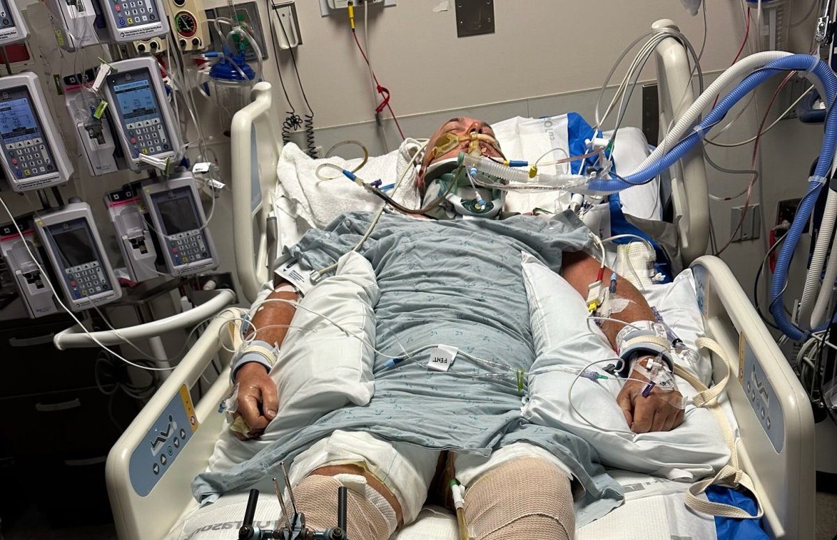 Winnipeg man Darren Stevenson is recovering in a Hawaiian hospital after surviving an explosion while on vacation.