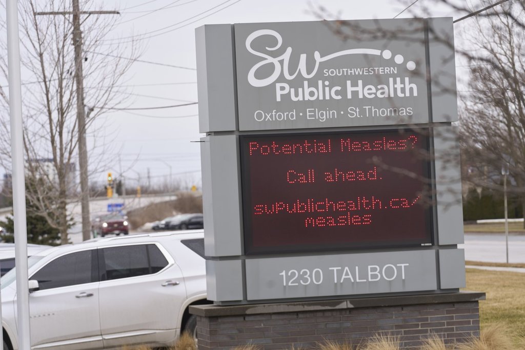 морбили се разпространиха до 109 повече души в Онтарио през