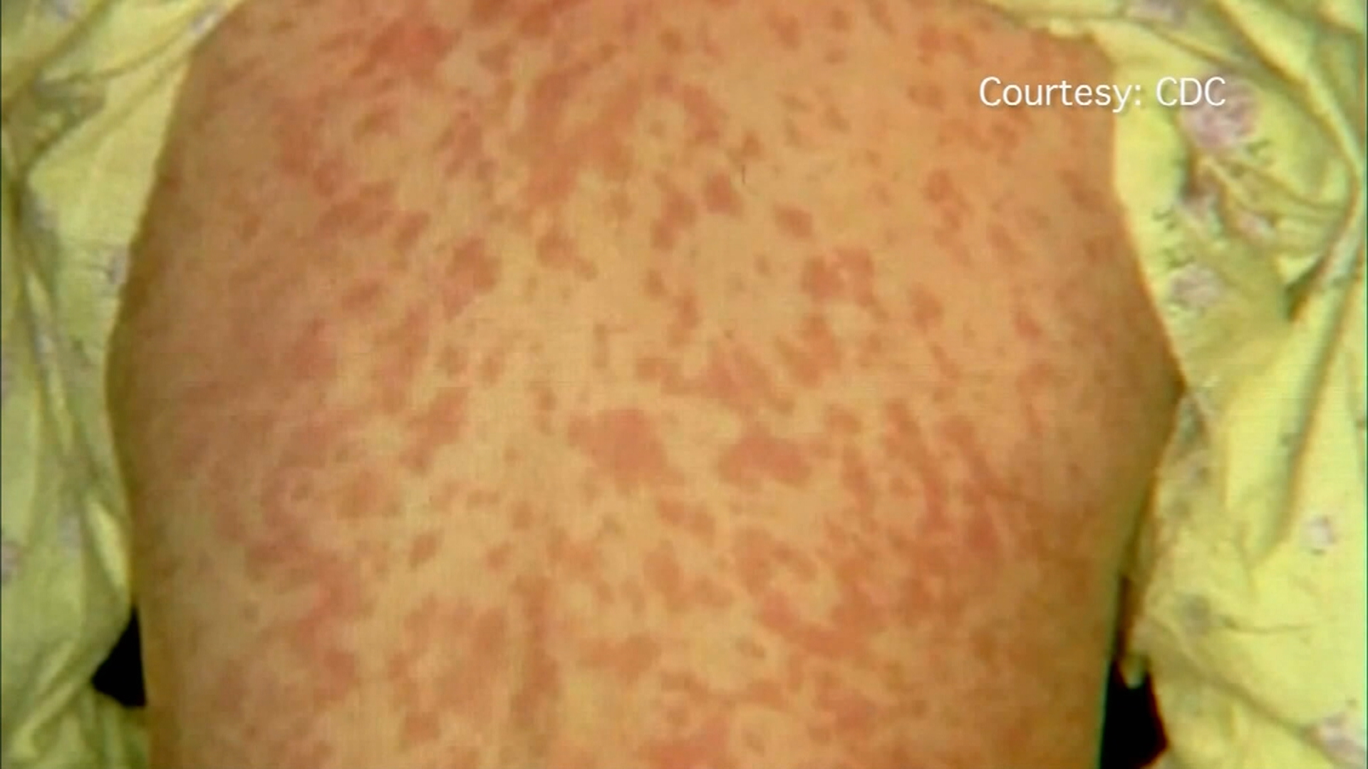 Alberta Health Services е издал съвет че хората които наскоро