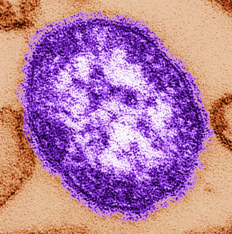 This undated image made available by the Centers for Disease Control and Prevention on Feb. 4, 2015, shows an electron microscope image of a measles virus particle, centre.