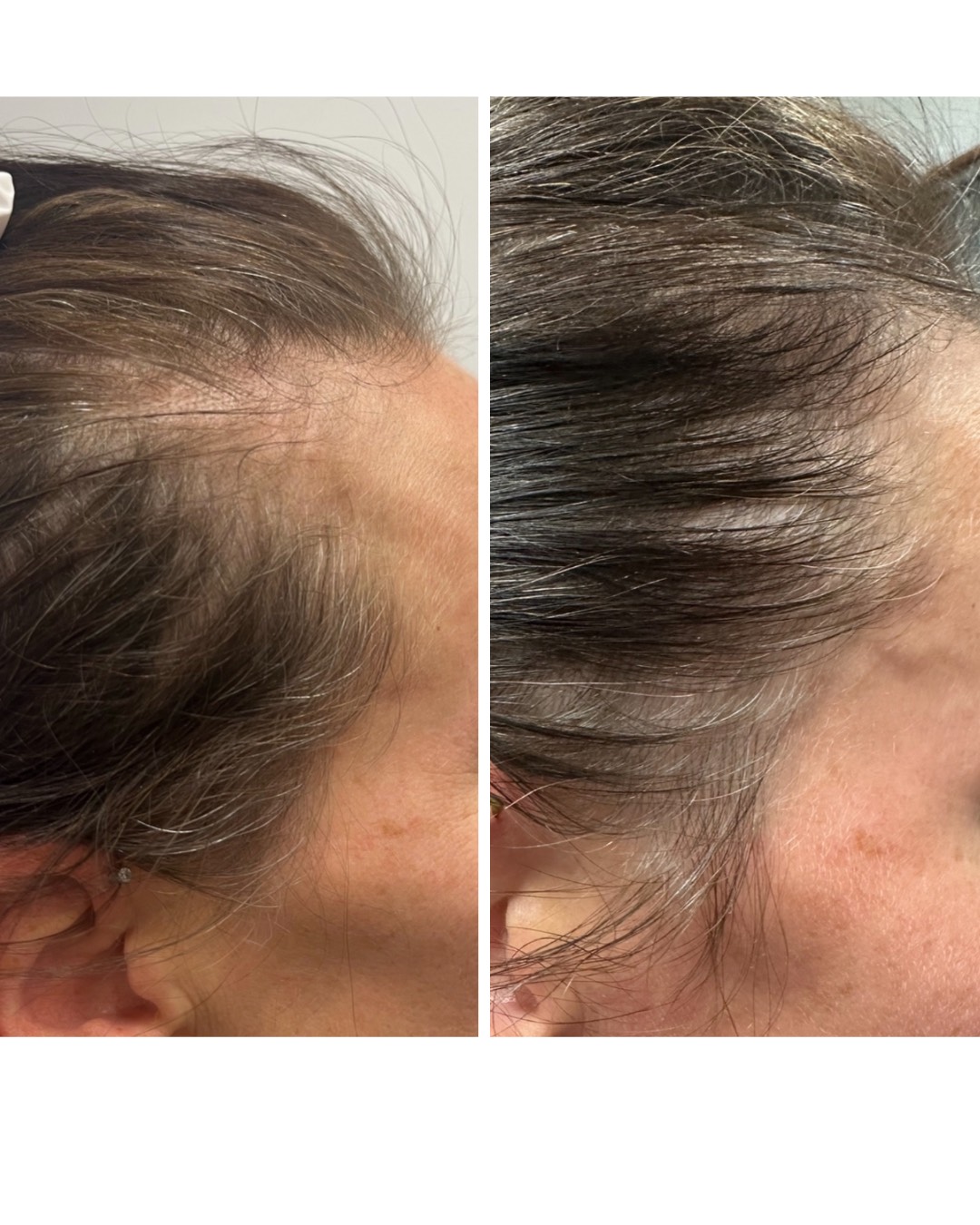 Клиниката за косопад в Саскатун е принудена да премества места