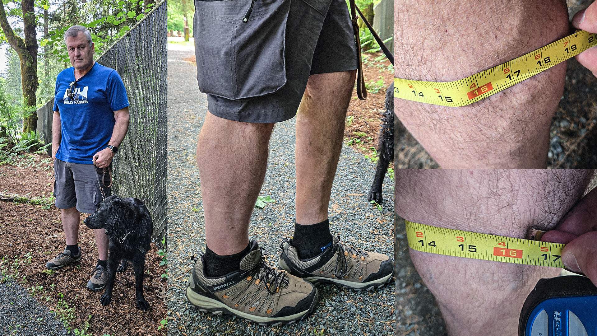 Photos of Mike Becker's normal leg and other one swollen by clots