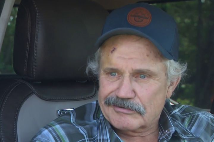 Мъж от Алберта наскоро е получил счупен крак след като