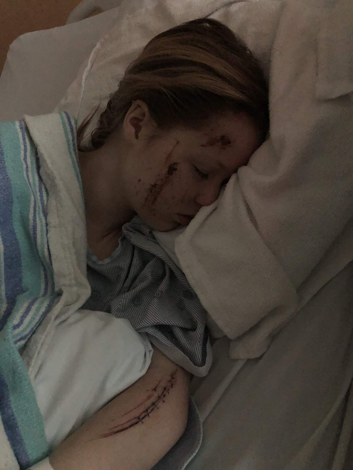 Corinne Cameron spent three months in hospital after the August 2023 crash.