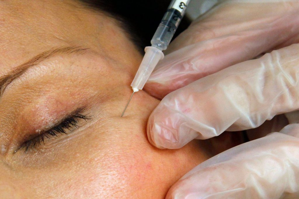 FILE - A patient receives a Botox injection at a clinic in Arlington, Va., on June 5, 2009. (AP Photo/Jacquelyn Martin, File).