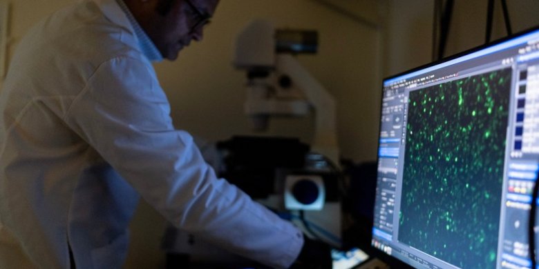 There are more than 100 autoimmune diseases, and they mostly strike women. Here’s what to know