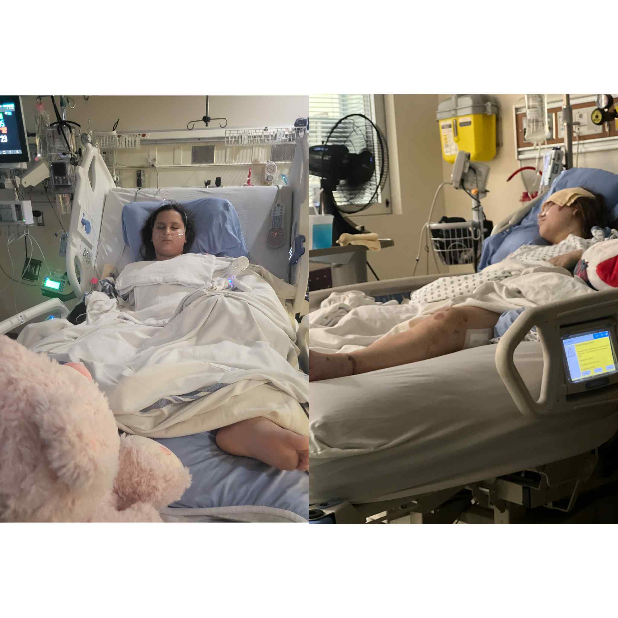 Calgary family wants intersection changes after sisters seriously injured in collision