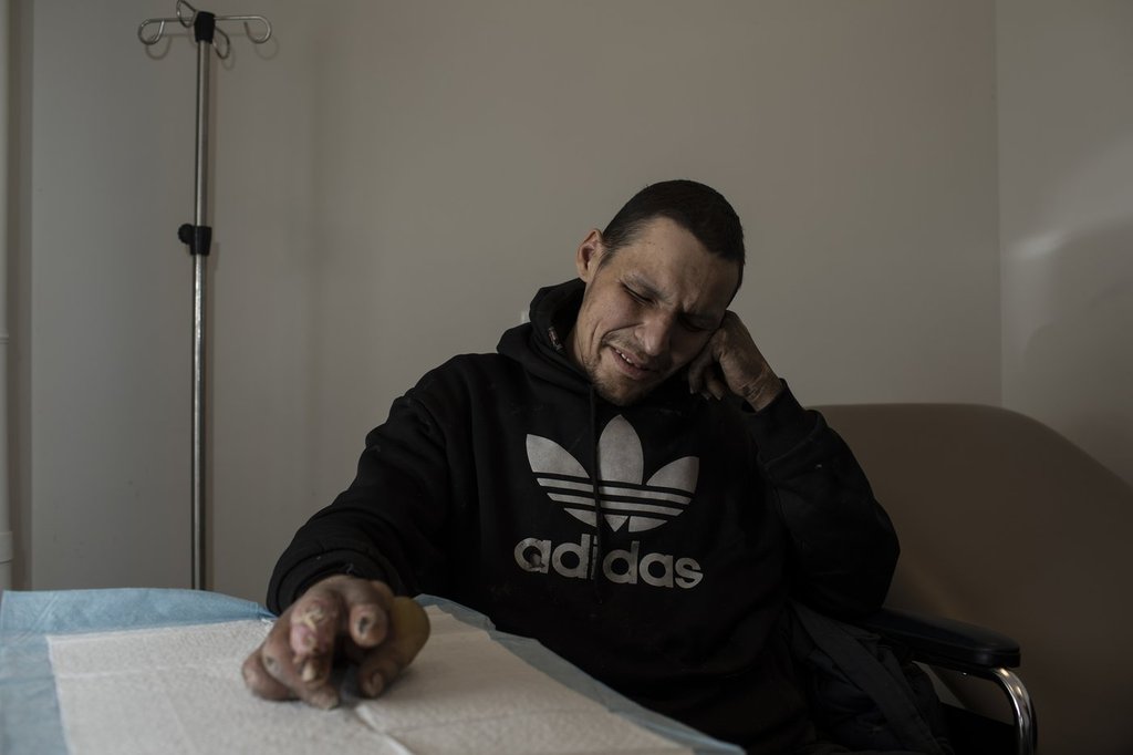 Тревър Лоугън трепва от болка докато медицинска сестра почиства покрития