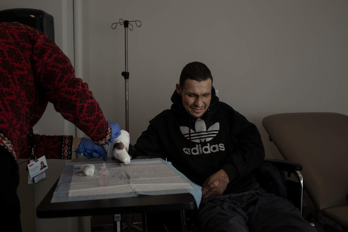 Trevor Logan, from Calling Lake, Alta., has serious frostbite injuries on his hand, and is getting wound care support at the Hope Mission in Edmonton on Monday, Dec. 22, 2025.