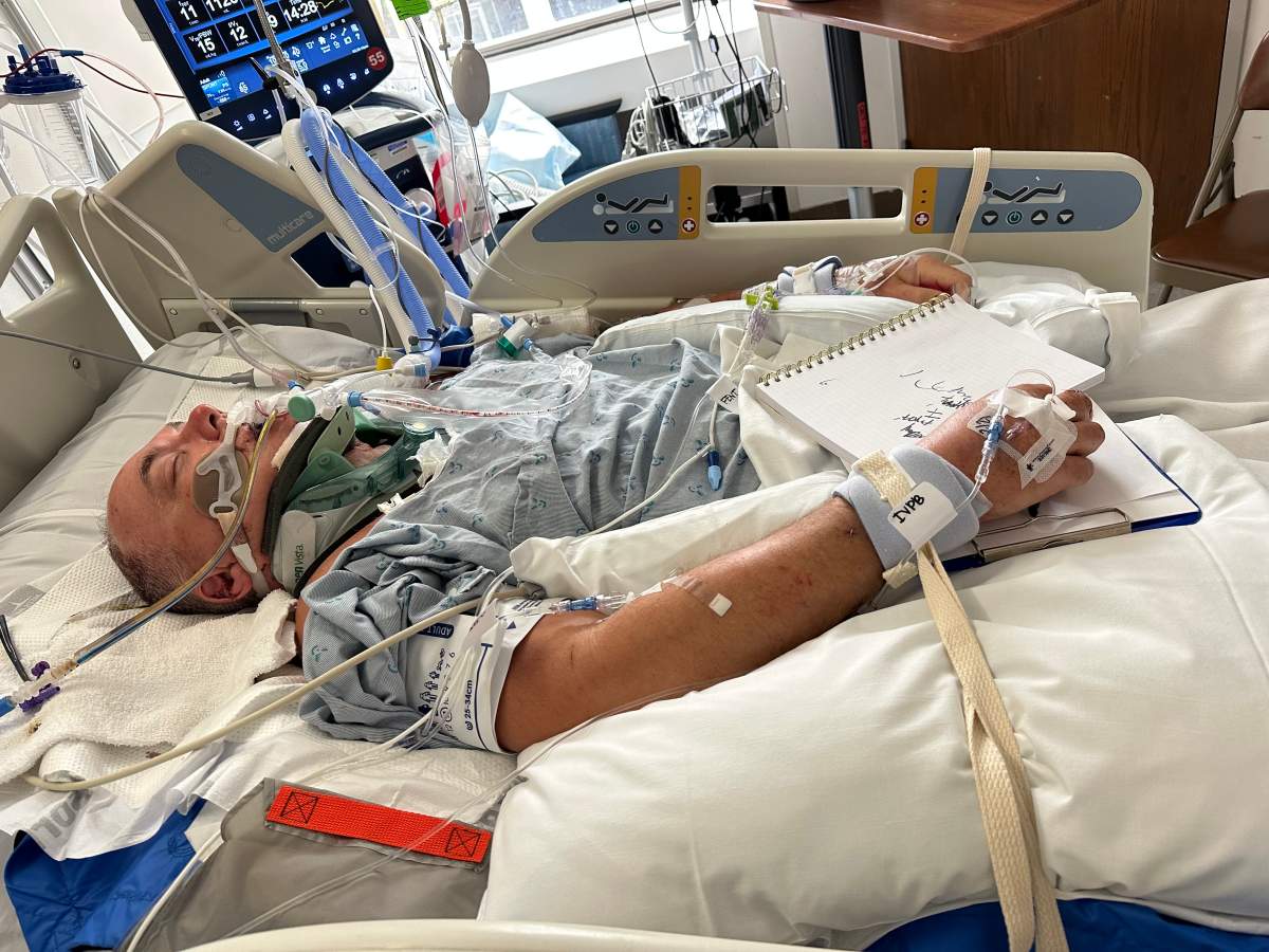 Darren Stevenson is pictured in hospital being treated for severe injuries he received when a barbecue exploded while he was cooking dinner.