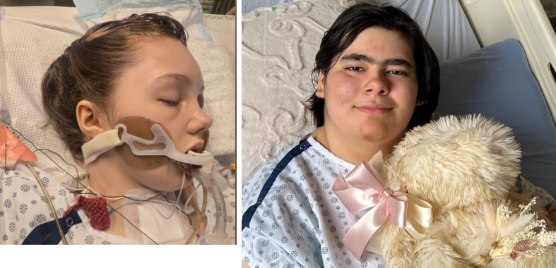 Една от оцелелите жертви на стрелбата в училище Tumbler Ridge