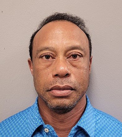 Tiger Woods had ‘glassy’ eyes, pills in pocket during DUI arrest: police