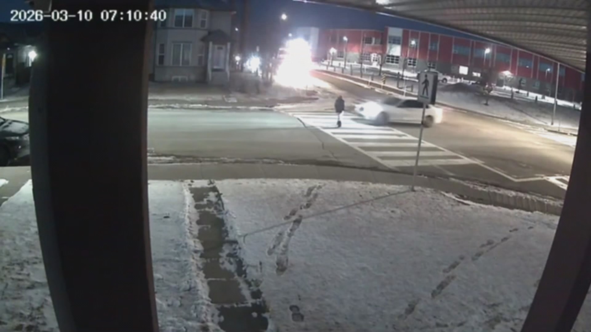 ‘Then he ran over my leg’: Calgary boy hit in crosswalk recovering at home - Calgary | Globalnews.ca