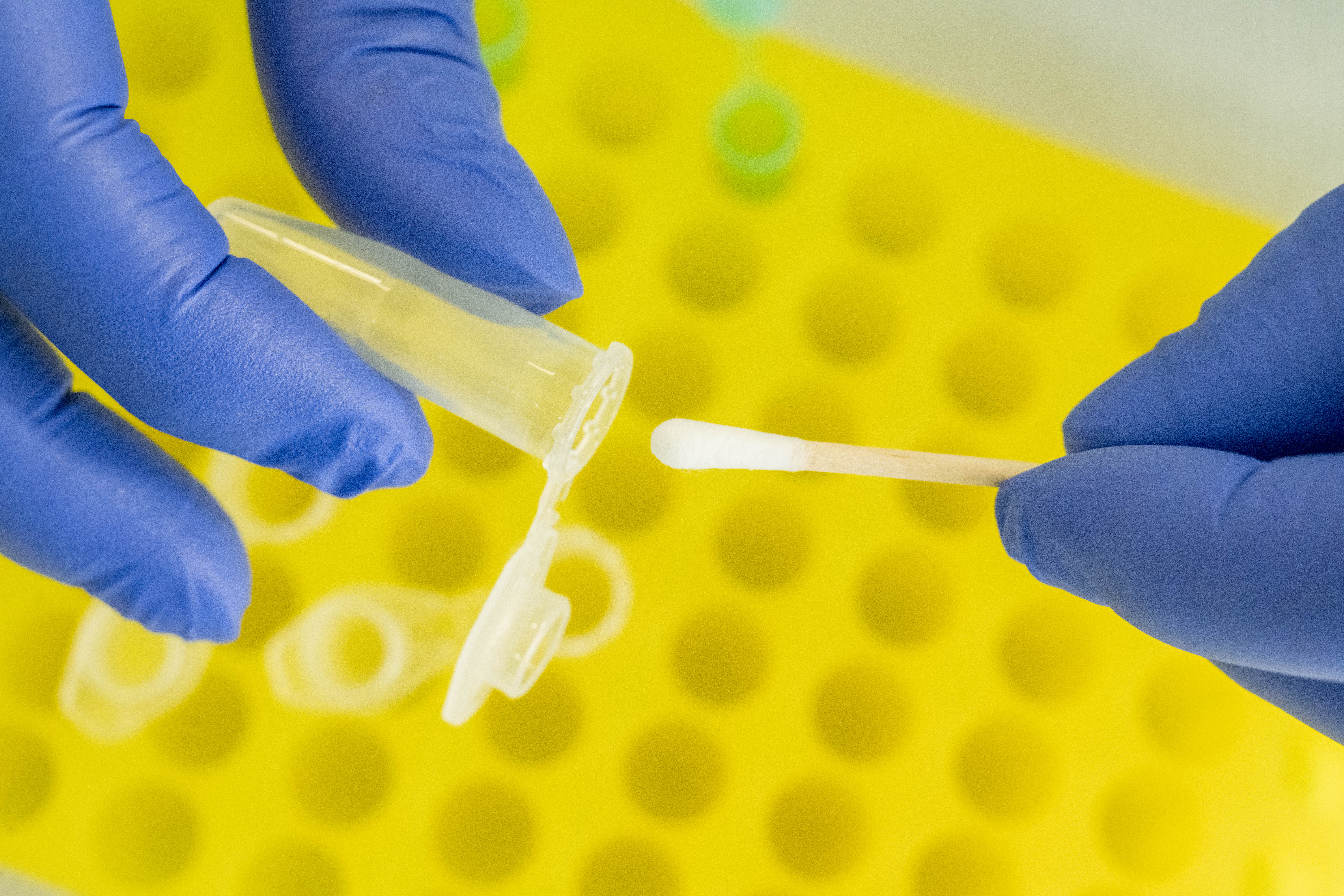 Man found dead in Lake Ontario in 1992 identified as Saskatchewan man: police